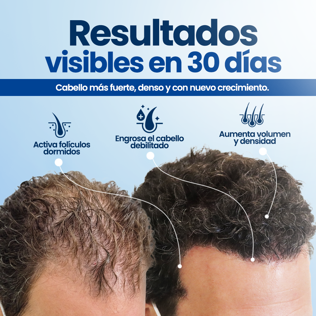 Roll-On de crecimiento Capilar