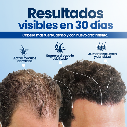 Roll-On de crecimiento Capilar