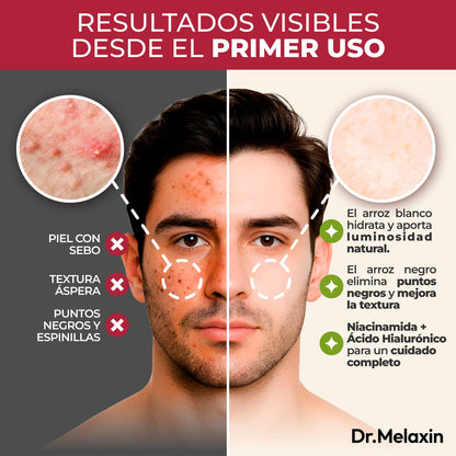 Dr. Melaxin – Tratamiento Dúo Peel Shot Glow con Arroz